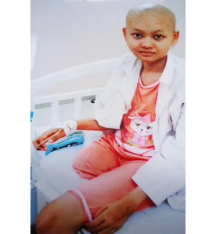 Cháu gái lớp 9 bị cắt chân vì ung thư